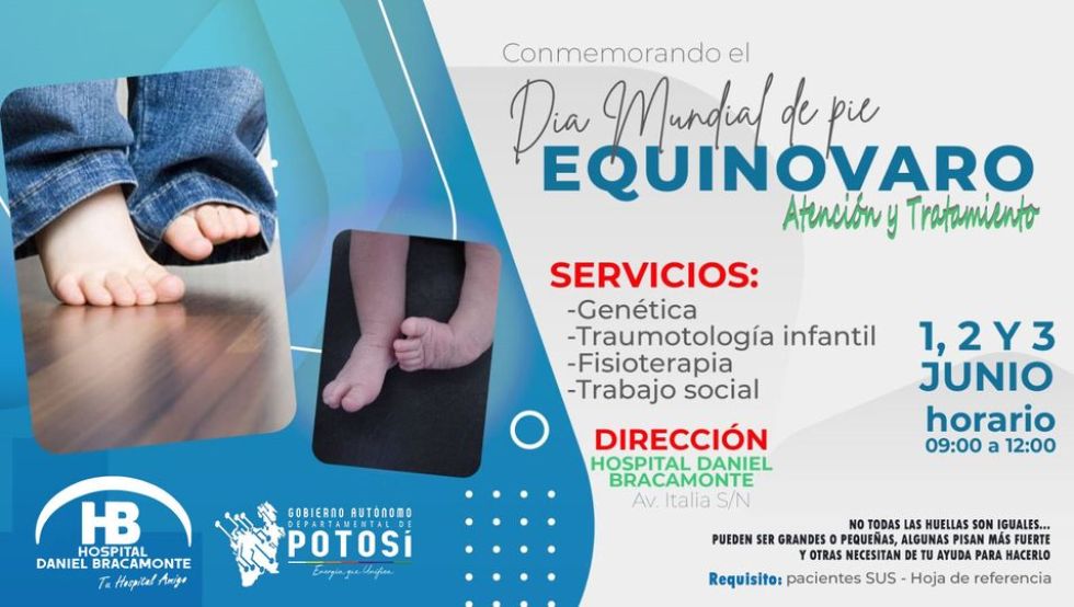 Campaña de pie equinovaro no solo será para pacientes SUS 