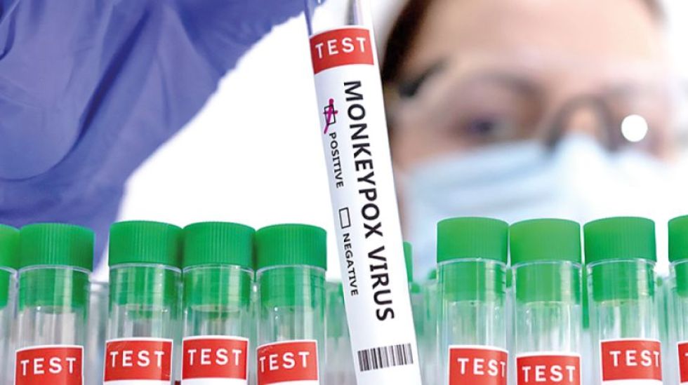 Bolivia confirma su primer caso de la viruela del mono