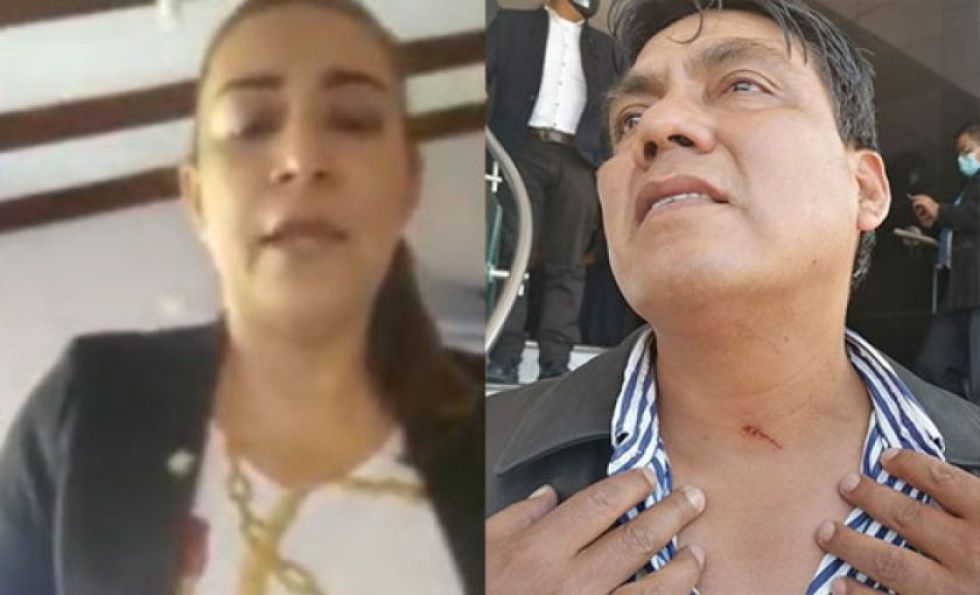 Fiscalía imputa a Diputada de Creemos por “arañazos” que denunció su colega Héctor Arce
