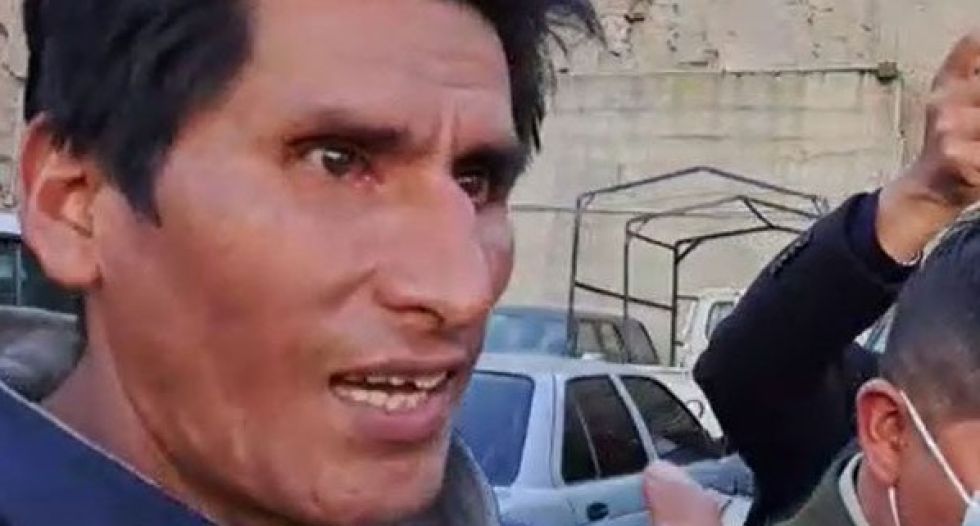Dictan prisión preventiva para el cocalero con discapacidad que es acusado de lanzar dinamita