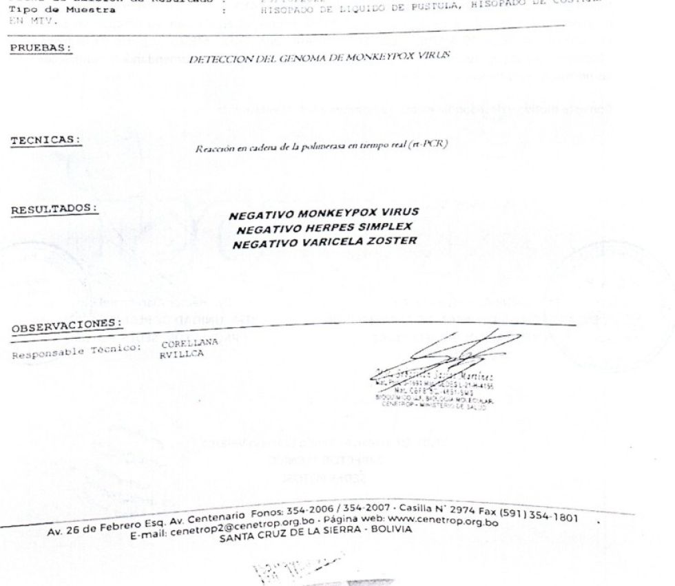 Reportan que casos sospechoso de viruela del mono dio negativo