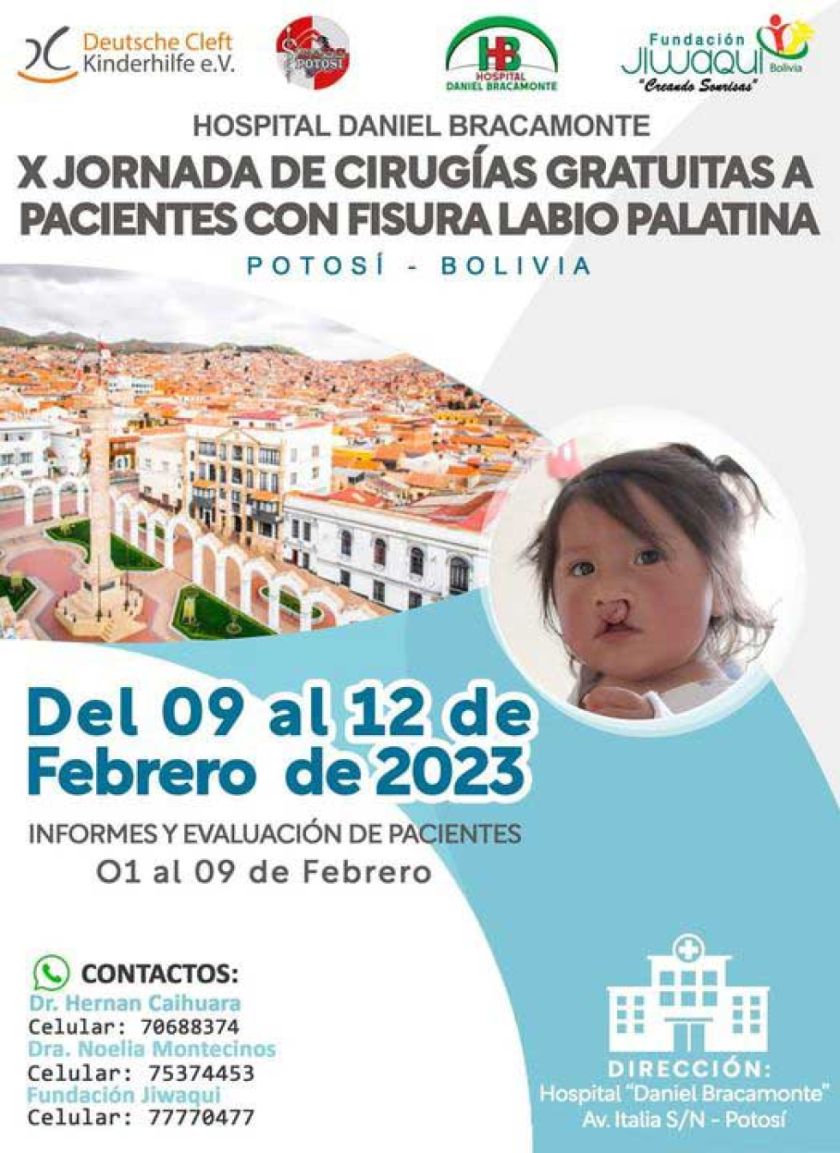 Realizarán cirugías labio palatinas gratuitamente
