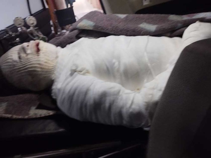 Hombre trató de matar a su concubina con gas