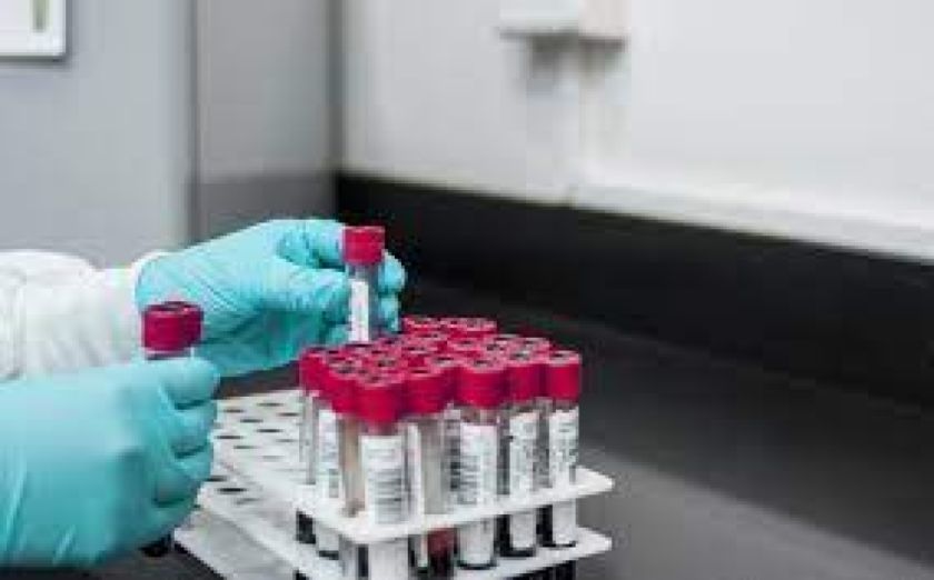 Nuevo contagio eleva a 16 los casos de virus de Marburgo en Guinea Ecuatorial
