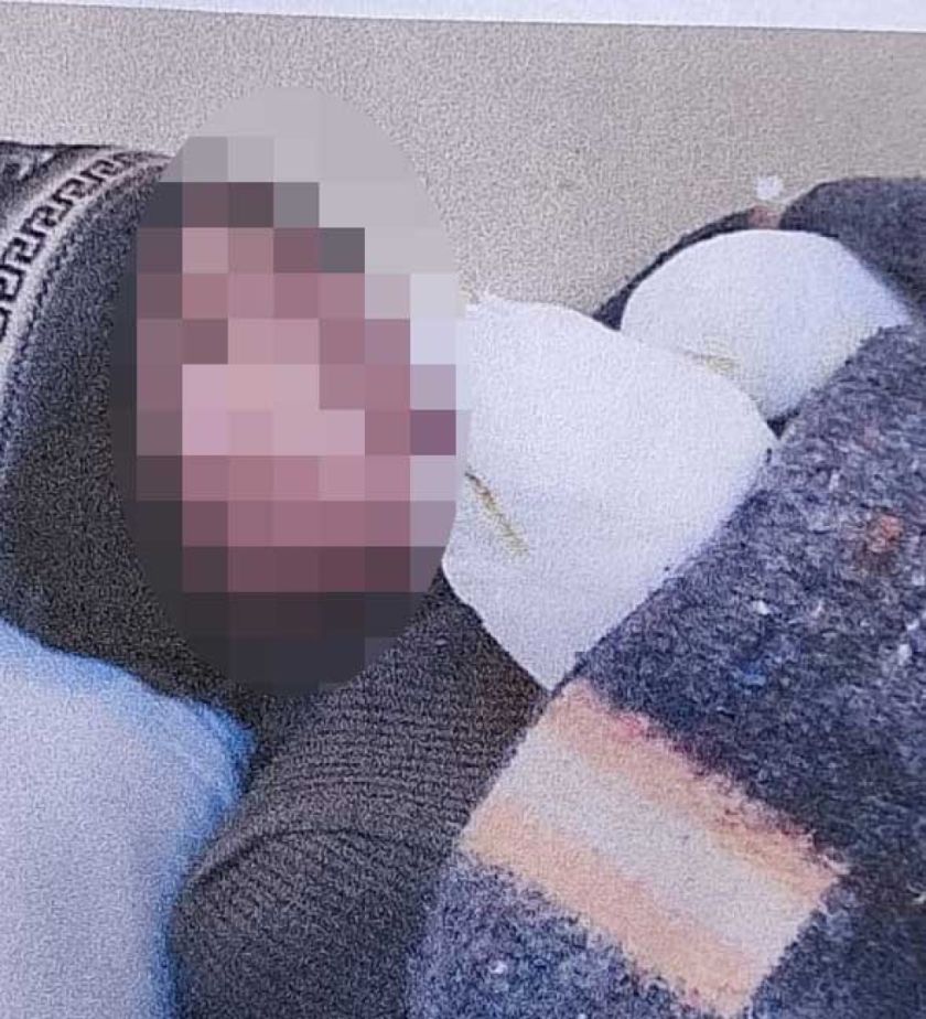 Niño muere quemado  y sus hermanos viven al incendio de pastizal