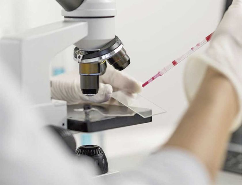 Suben casos de cáncer  en menores de 50 años
