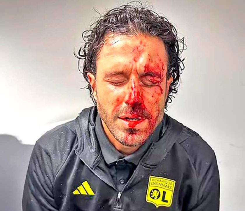 Suspenden por agresiones el partido Marsella-Lyon 