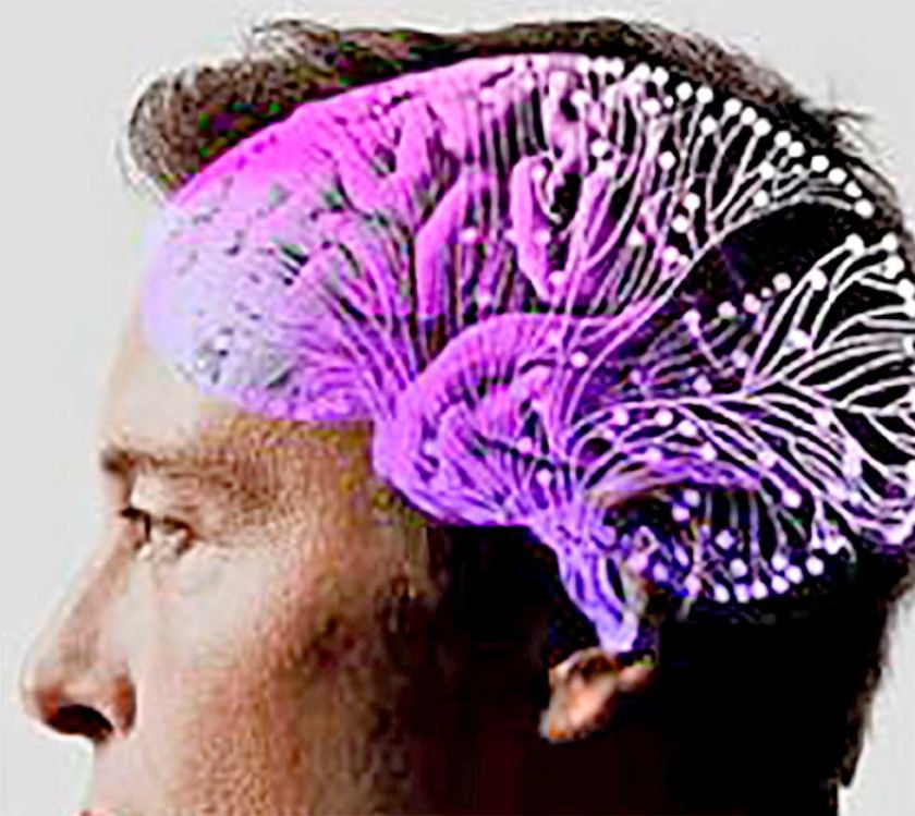 Implantan primer chip cerebral: ¿Qué supone?