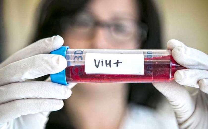 Potosí reporta 33 nuevos contagios de VIH en lo que va de la gestión 2024