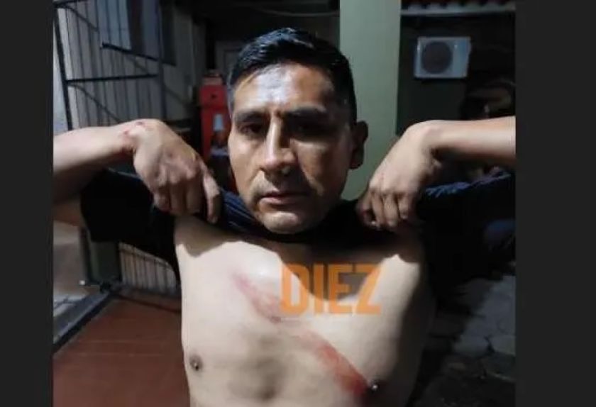 Agredieron al asistente William Medina que no dirigió Blooming - Nacional, pero que estaba en el hotel de los árbitros