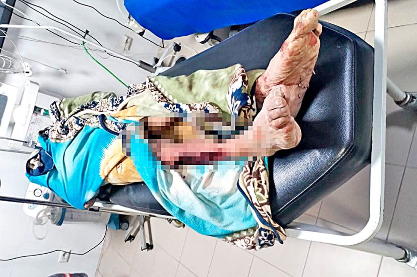 Jauría de perros asesina a hombre y devora parte del muslo derecho
