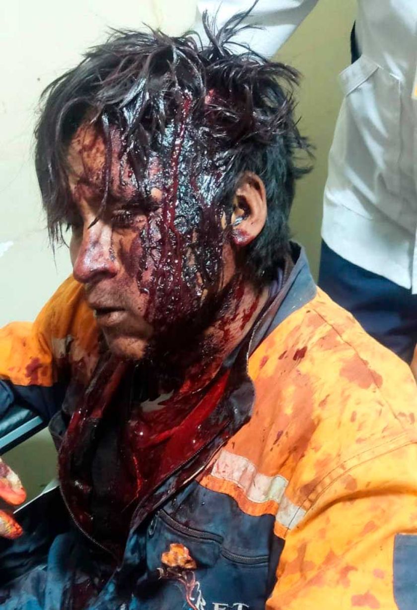 Un conflicto de terreno termina con un heridos
