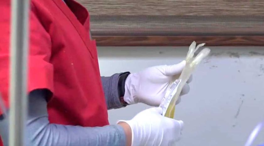 Por primera vez en Potosí se realiza plasmaféresis a un paciente