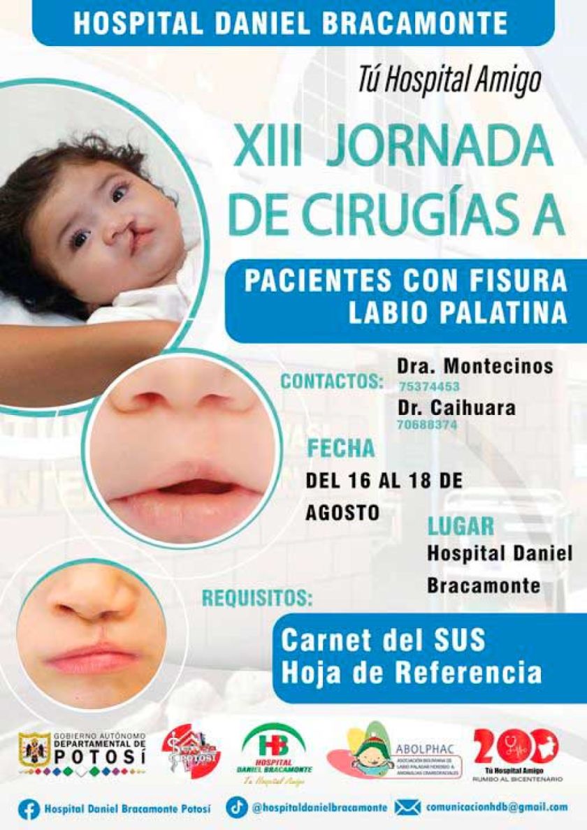 Atenderán a pacientes con fisura labio palatina