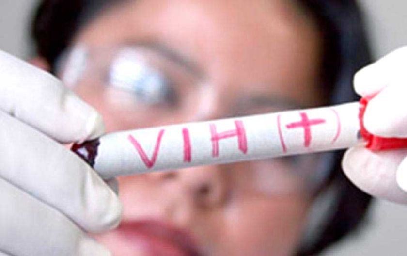 El Sedes está preocupado por el aumento de casos de VIH en Potosí