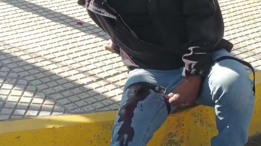 Apuñalan a un motociclista que intentaba pasar un punto de bloqueo en Oruro