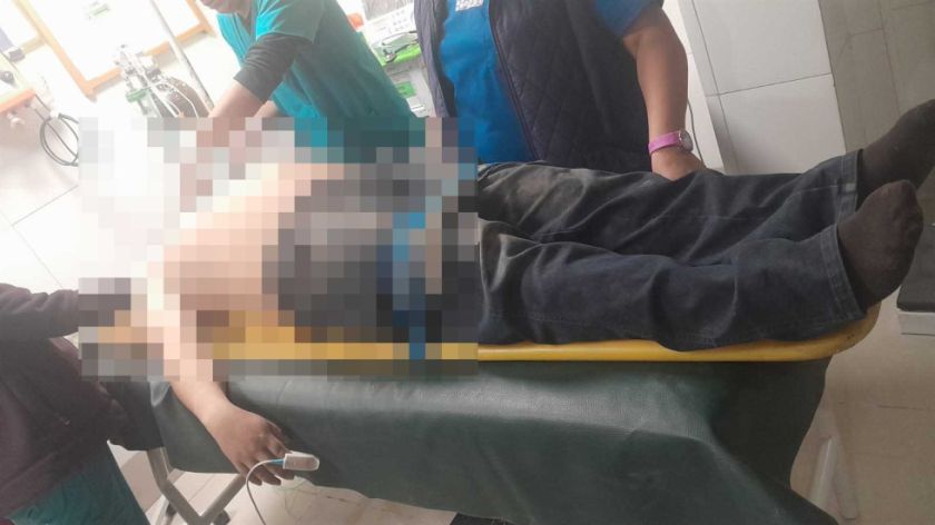 Joven muere atropellado por conductor con aliento alcohólico