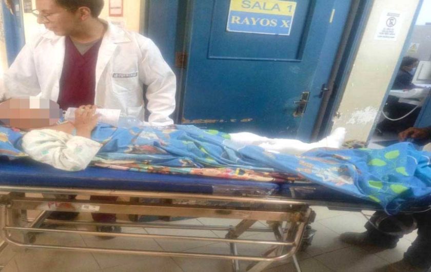 Niño de 11 años queda con fractura de pierna tras ser atropellado