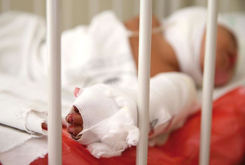El Salvador: hay 11 niños quemados con pólvora durante las festividades por Nochebuena