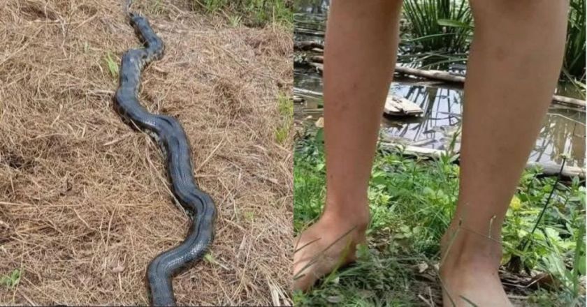 Niño de 10 años es atacado por una serpiente sicurí de dos metros en Beni