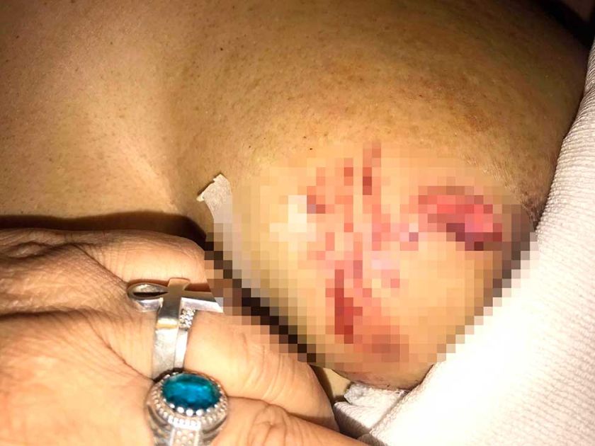 Dos pitbull atacan a una  mujer y se llevan bolsa de carne en sus hocicos