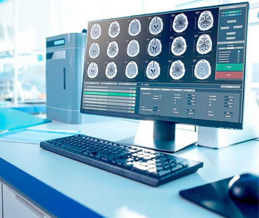 Los cerebros envejecieron  más rápido en el covid-19