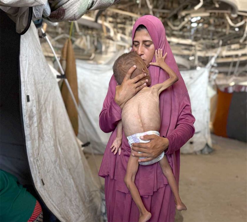 Alertan riesgo de muerte  para miles niños en Gaza