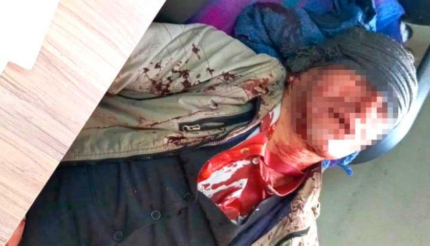 Turba ataca Catastro y la Alcaldía denuncia toma con heridos, uno grave