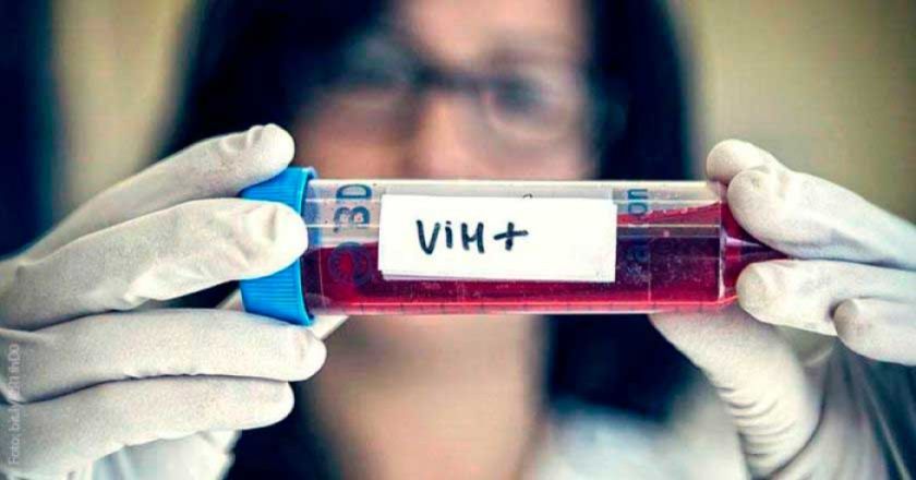 Potosí presenta 60 casos de VIH en lo que va de la gestión