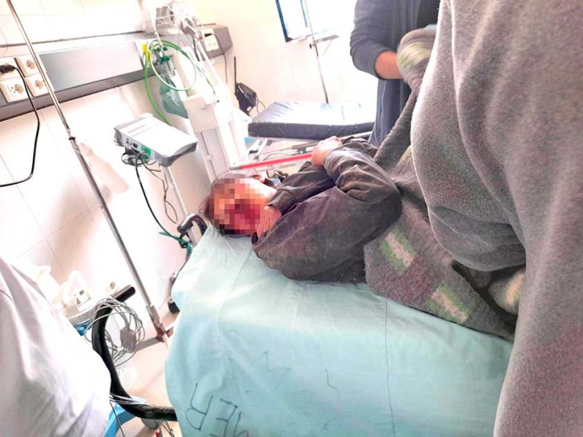 Conflicto familiar por mina de plata termina con 18 personas heridas