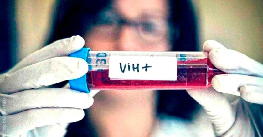 El Sedes reporta 37 casos de VIH en Potosí en lo que va de la gestión