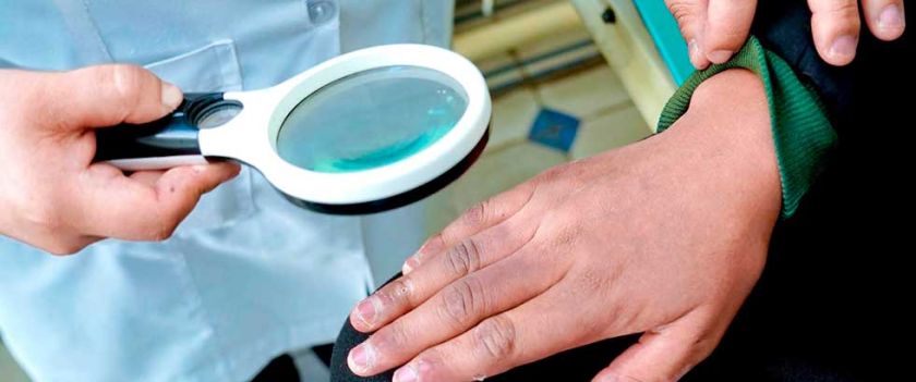 Detectan casos de cáncer de piel tras campaña de salud