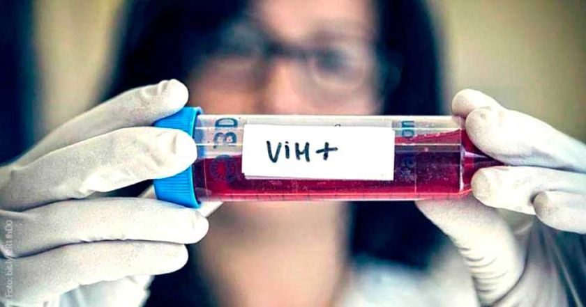 Los casos de VIH disminuyen en el Departamento de Potosí 