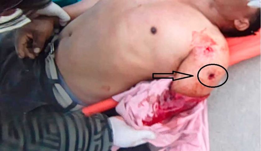 Tres policías aprehendidos por  muerte de un hombre por bala