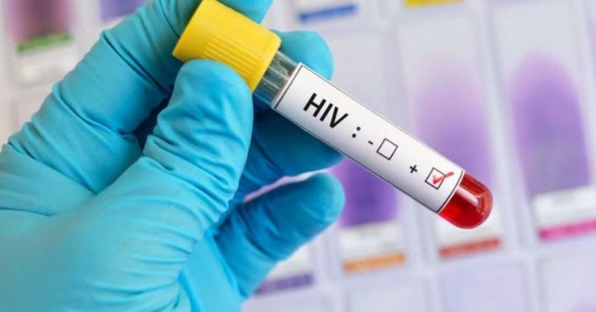 Autoridades de salud alertan sobre más de 46.000 casos de VIH en Bolivia