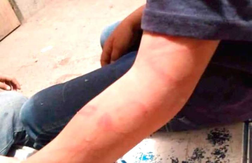 La Defensoría rescata a un  menor víctima de golpizas        