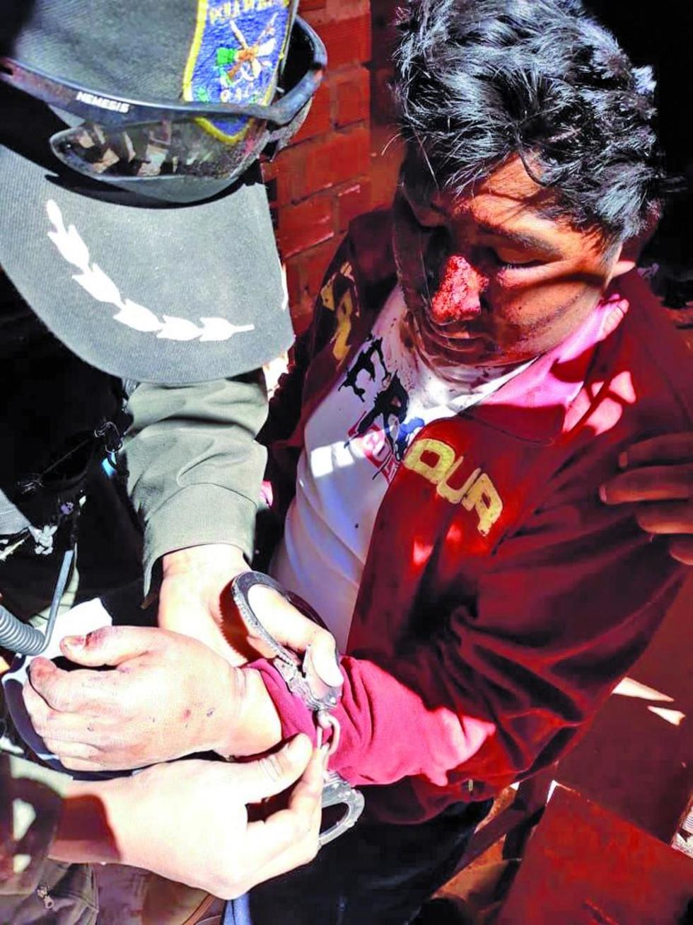 A Gustavo Esquivel se le ve ensangrentado y con marcas en la mano.