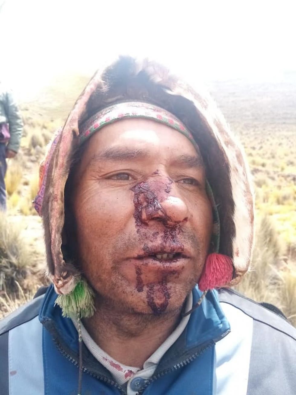 Fotografías de algunos heridos.