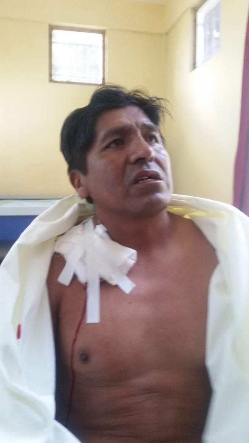 Los heridos en Challapata.