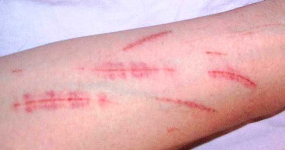 Alerta del FBI destapa en  Tupiza red de instigación  al suicidio y ‘cutting’ 